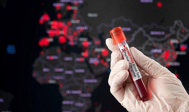 Yeni öldürücü hastalık varyantı kontrolsüzce yayılıyor! Uzmanlar uyarıyor: Yüz binlerce kişiyi etkileyebilir