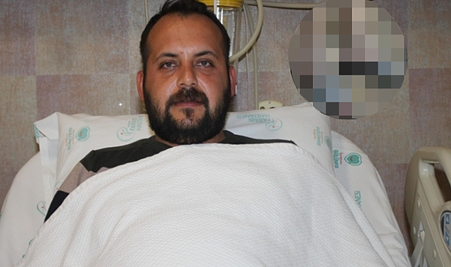 Aylardır yürüyemiyordu! Hastanelik olunca gerçeği öğrendi! Bakın ayağından ne çıktı!