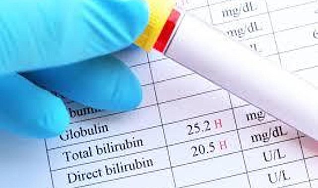 Bilirubin Ne Demek? Bilirubin Yüksekliği Ve Düşüklüğü Ne Anlama Gelir?