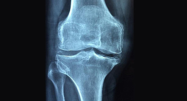 Dikkat! Sessiz ilerliyor: 