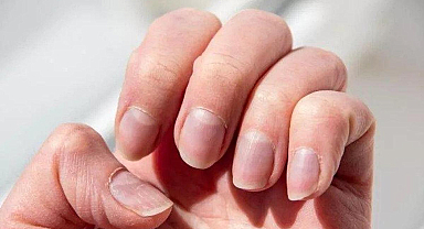Tırnak sağlığını ihmal etmeyin! Tırnak İçin Hangi Doktora Gidilir? Tırnak Hastalıklarına Hangi Bölüm Bakar?
