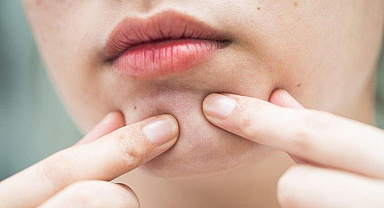 Yağ Bezesi İçin Hangi Doktora Gidilir? Yağ Bezelerine Hangi Bölüm Bakar?