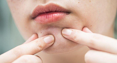 Yağ Bezesi İçin Hangi Doktora Gidilir? Yağ Bezelerine Hangi Bölüm Bakar?