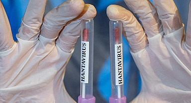 Hantavirüs'ün yayıldığı gemide mahsur kalan doktor, hastalığın nasıl başladığını anlattı