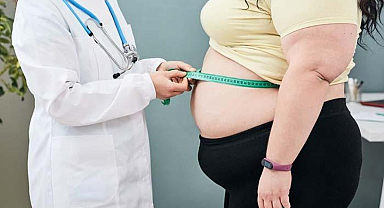 Obezite Tedavisinde Endoskopik Mide Uygulaması Nedir?