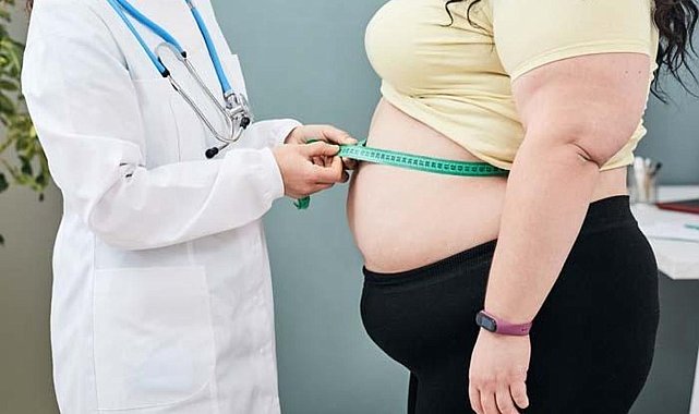 Obezite Tedavisinde Endoskopik Mide Uygulaması Nedir?