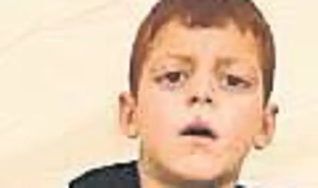 Kırılan gözlüğü ile İsrail zulmünü haykırdı