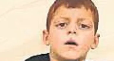 Kırılan gözlüğü ile İsrail zulmünü haykırdı